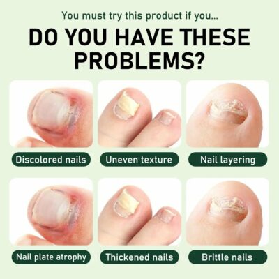 Umex tea tree nail serum for hands and feet