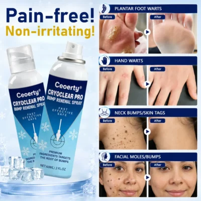 Ceoerty® CryoClear Pro Renewal Spray with centella asiatica and tea tree oil