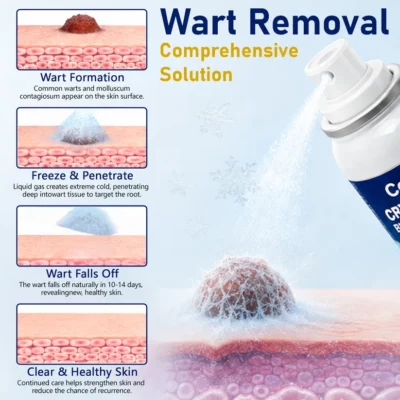 Ceoerty® CryoClear Pro Renewal Spray