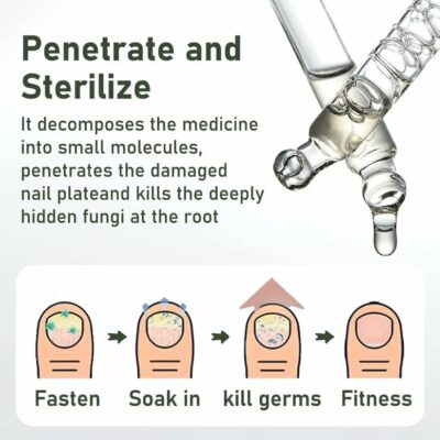 Umex nail serum for daily cuticle care
