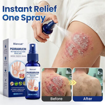 Biancat® fine mist for dry, flaky skin