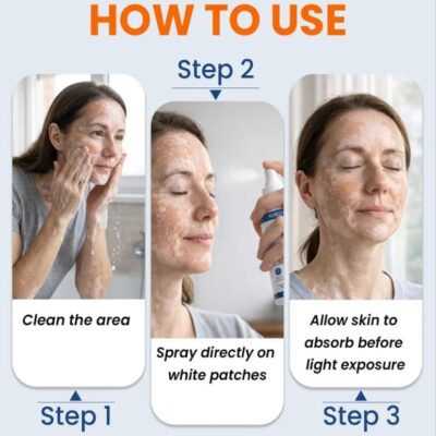 KUBOZN® Piperine Repigment Activator Spray with piperine, bakuchiol and Ginkgo biloba