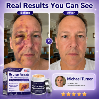 Rolimey® Bruise Repair Cream with vitamin K
