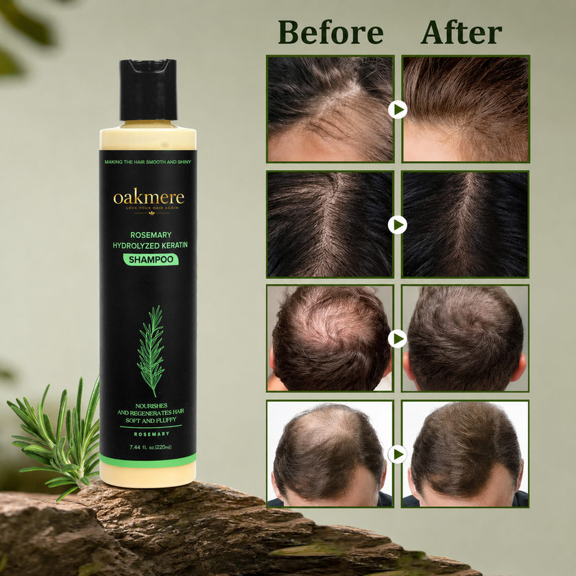 Oakmere® sulfate-free rosemary shampoo
