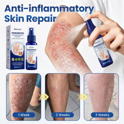 Biancat® skin mist with colloidal oatmeal