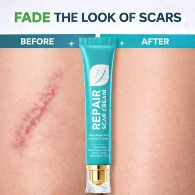 Alisanda Scar Repair Cream turquoise tube with white lettering