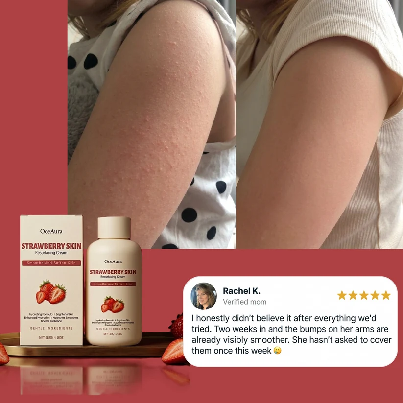 OceAura Strawberry Skin Cream with 6% glycolic acid