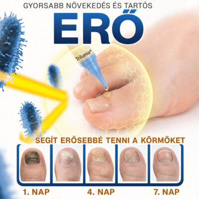 Trilumia FungiFree Méhmérges Körömkezelés