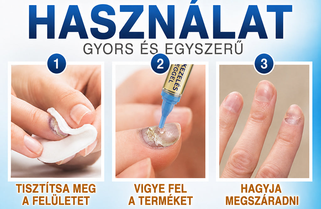 Trilumia FungiFree körömápoló szérum precíziós adagolóval