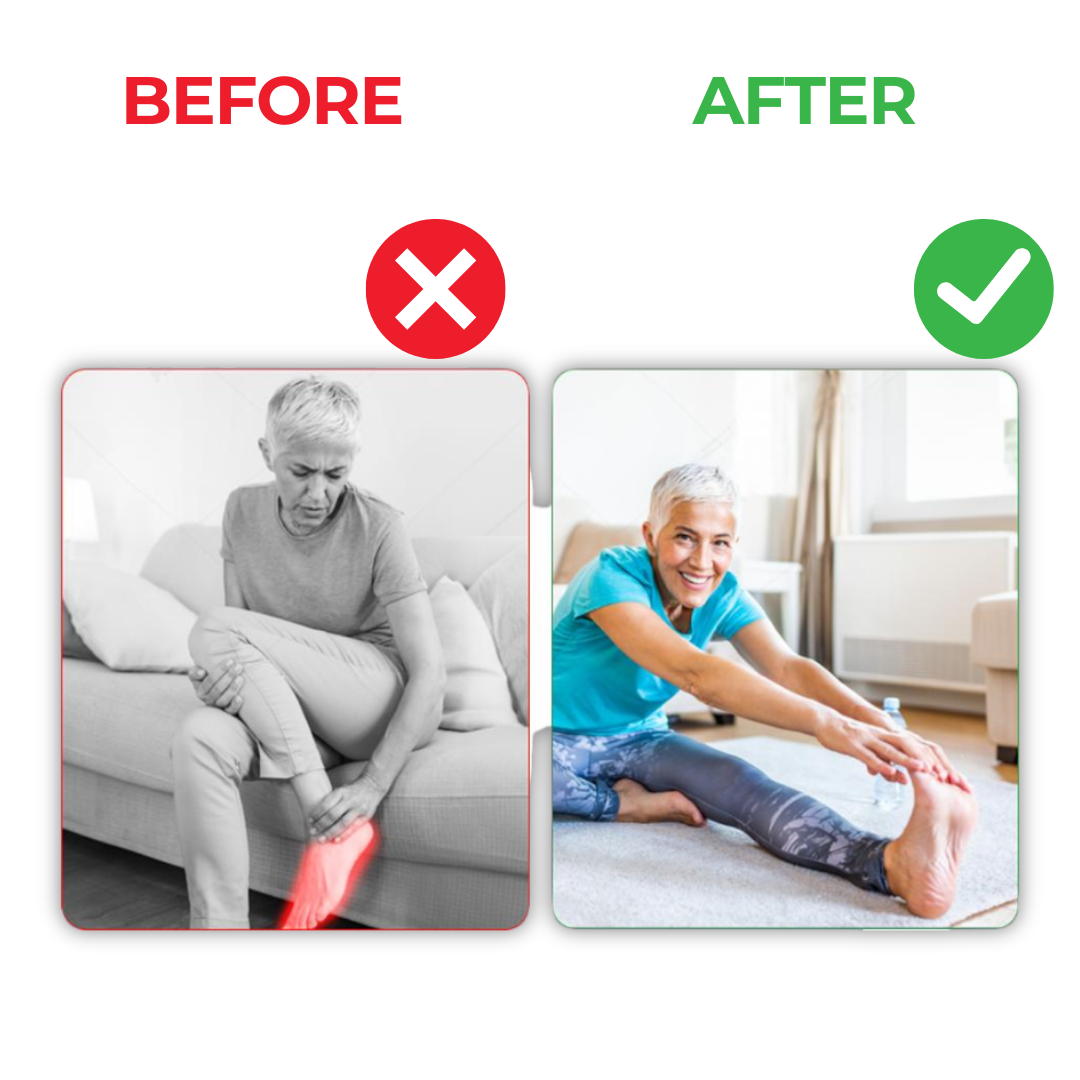 VeinRestore natural leg serum with horse chestnut extract