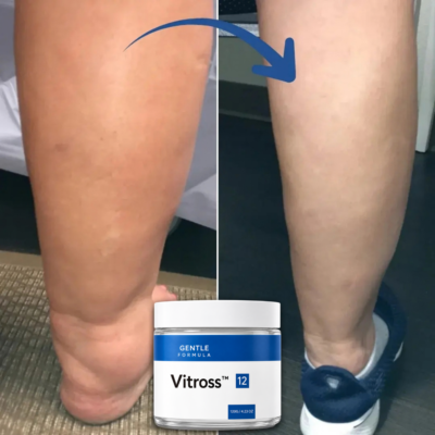 Vitross cream applied in the morning and evening