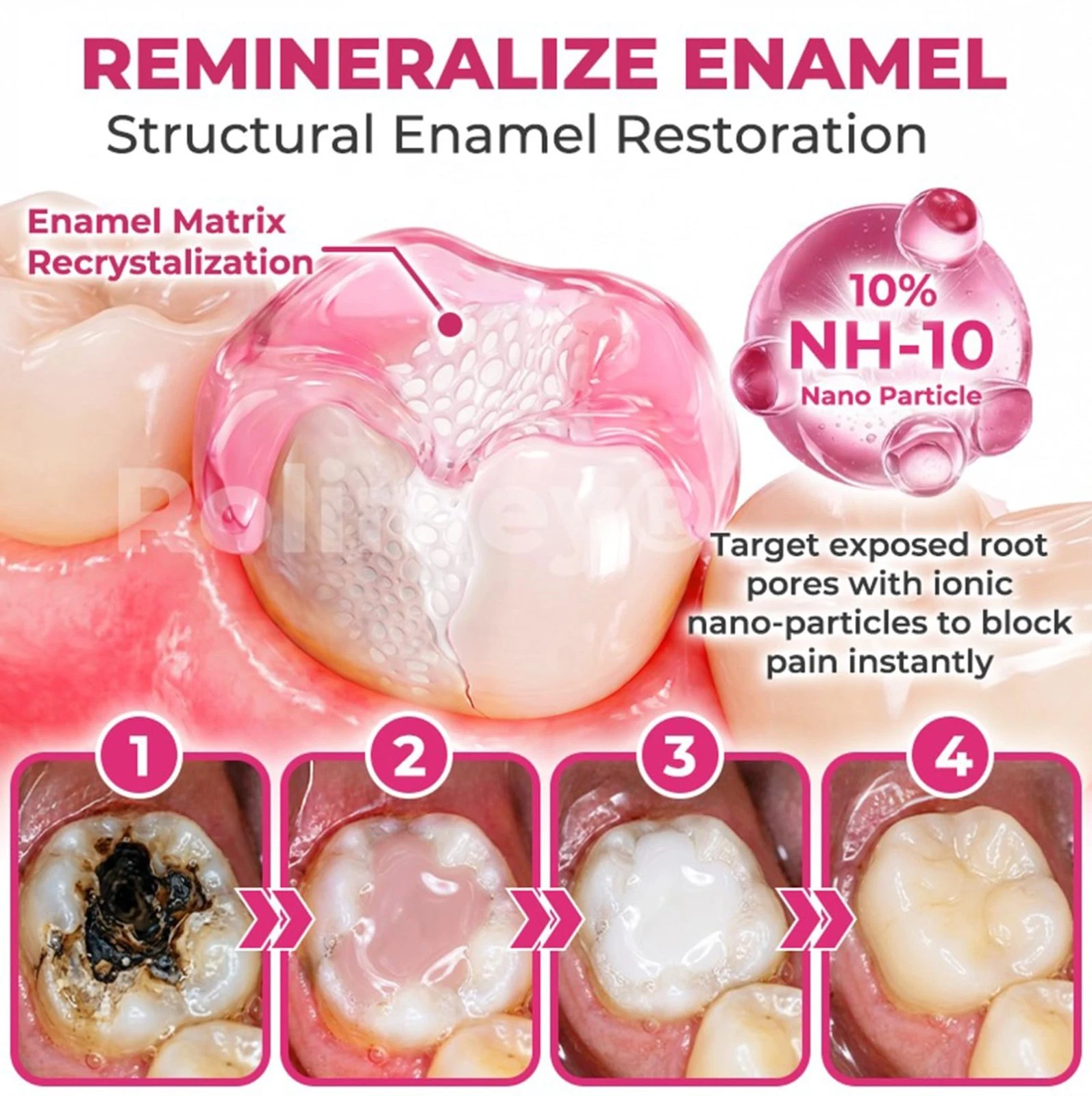 COUGEX gel intended for focused application to tooth surfaces
