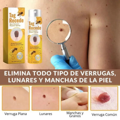 Tag Recede™ Eliminador de Verrugas Original