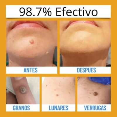 Tag Recede envase con mecanismo de pulverización para dispensar el líquido