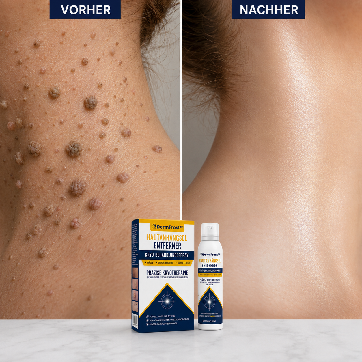 DermFrost Formel mit Glycerin